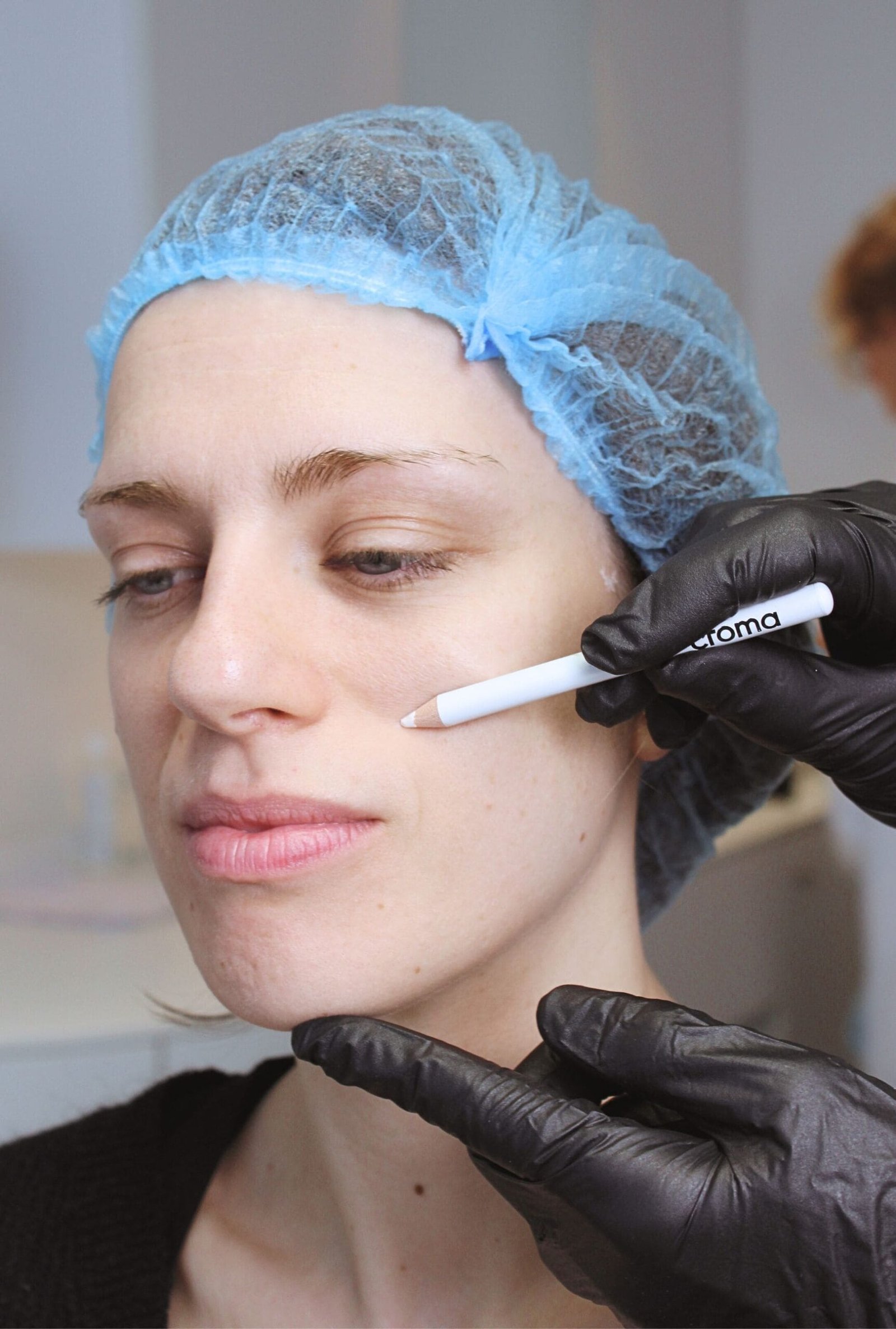 Chirurgie dermatologique à Saint-Malo