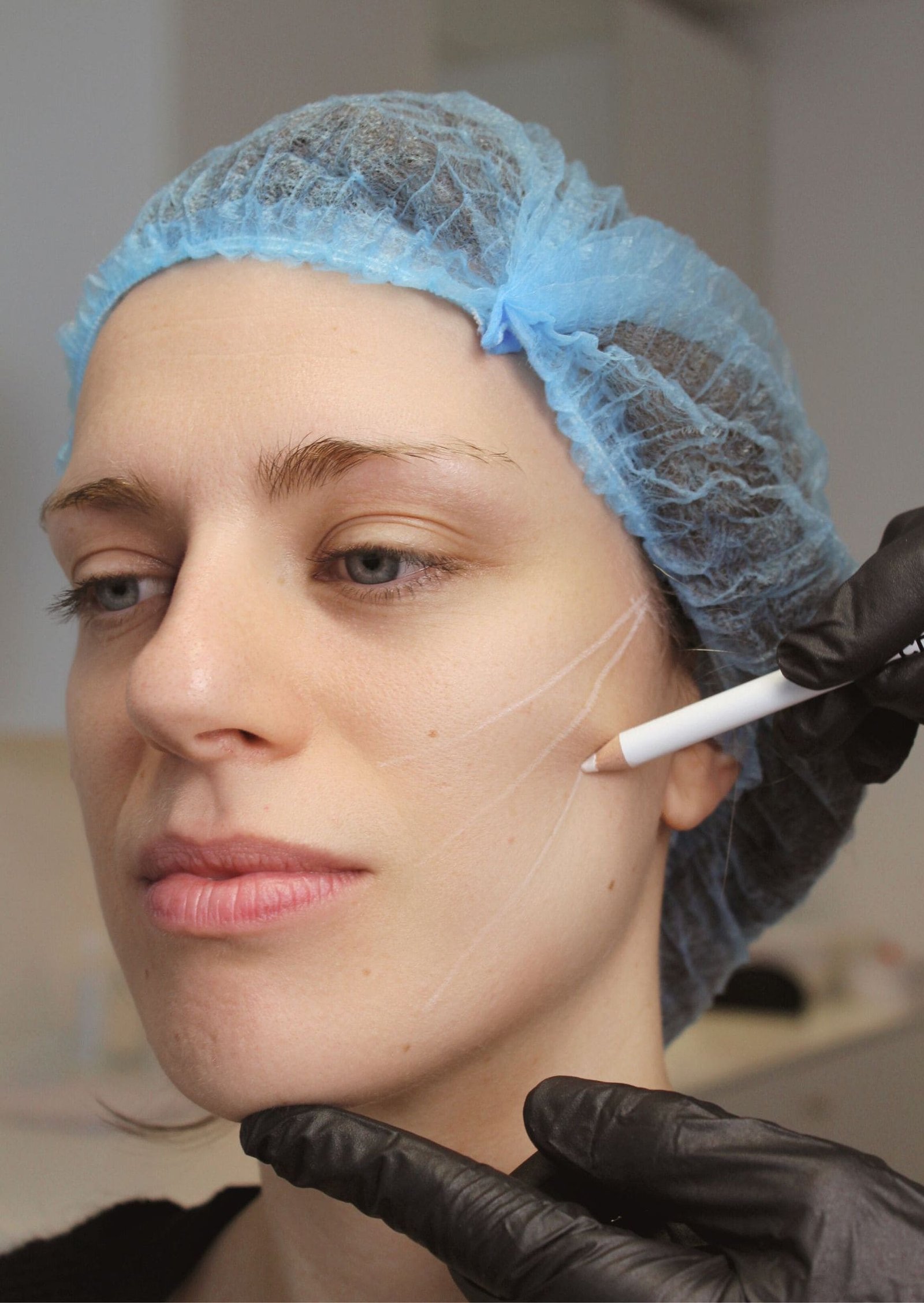 Fils tenseurs pour la chirurgie du regard