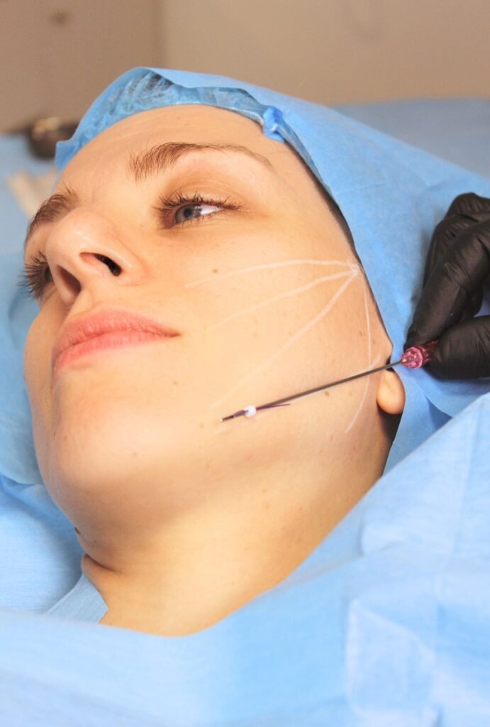 Fils tenseurs pour l'ovale du visage