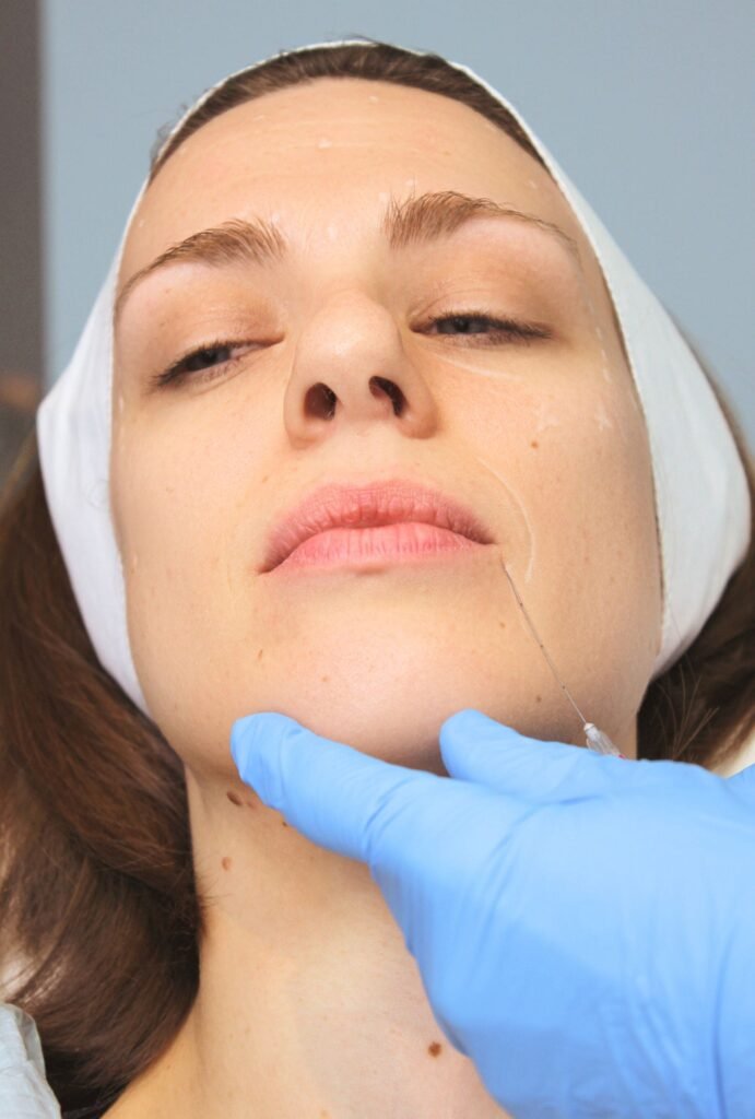 Injection de botox dans le menton