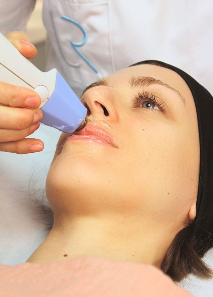 Radiofréquence pour les lèvres